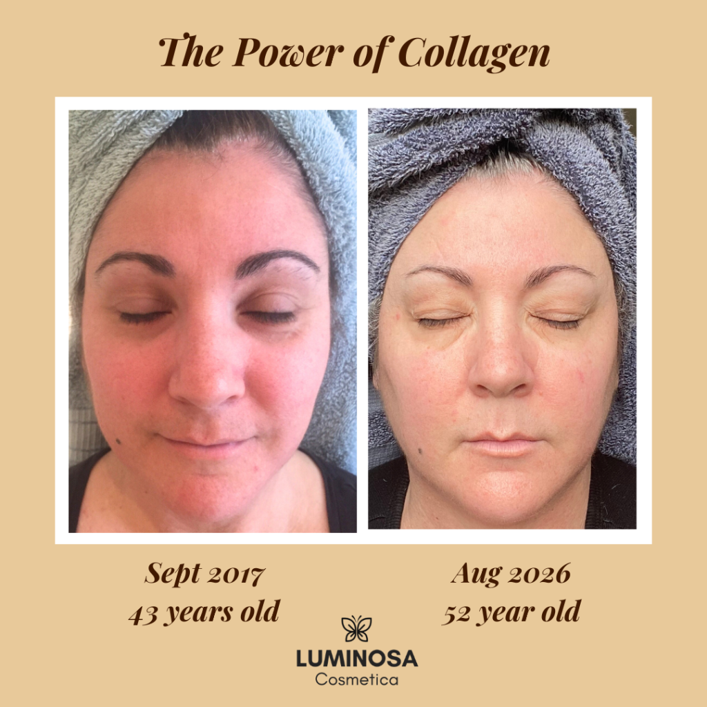 A before-and-after comparison graphic for LUMINOSA Cosmetica showing a woman's face with dates and age.